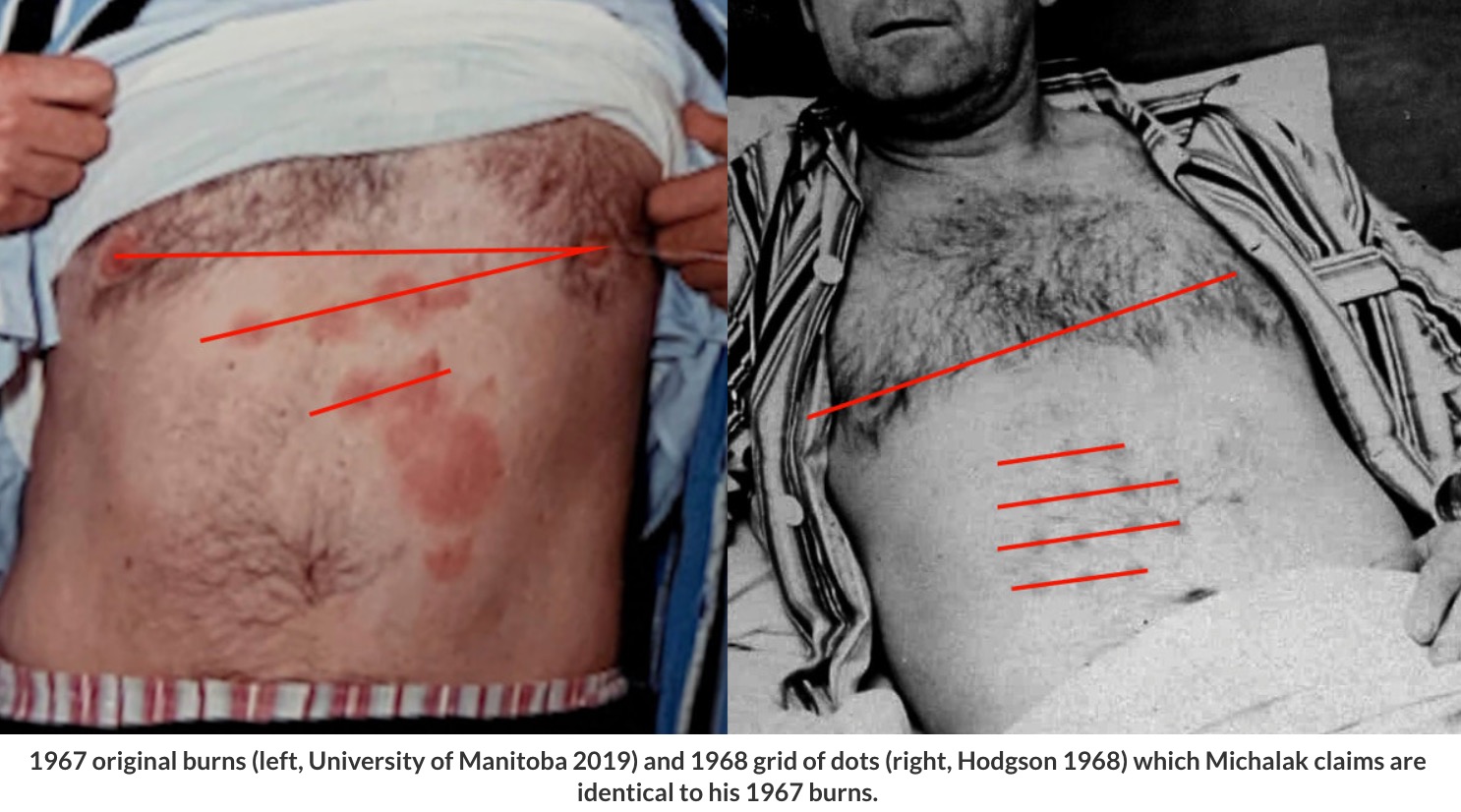 Claims: Physical Evidence of Steve Michalak's Falcon Lake UFO Incident
