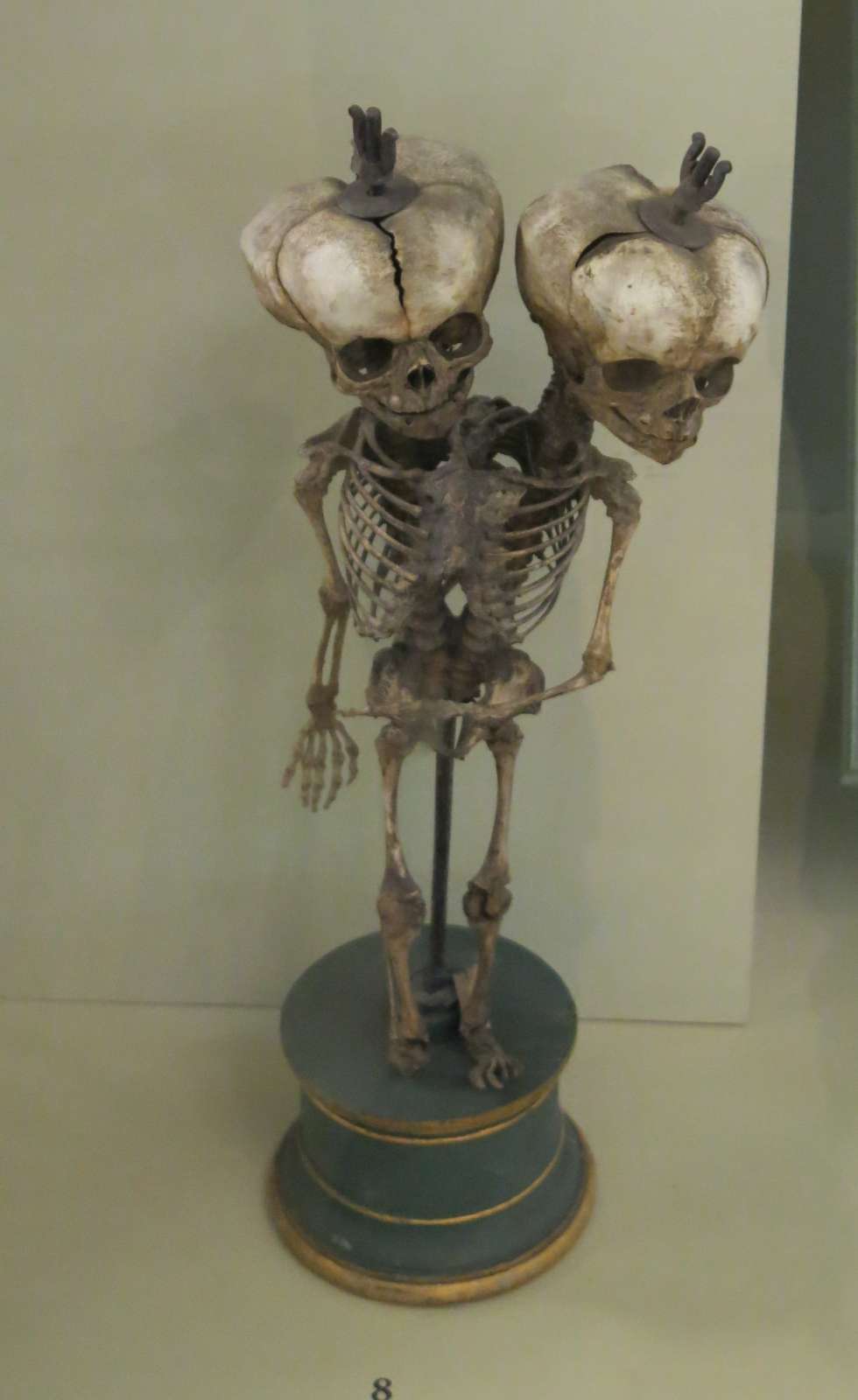 skelett-1.jpg