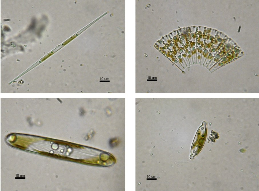 contrailscience.com_skitch_Diatomeas_w.jpg__281931_C3_971414_29_20110520_103345.jpg