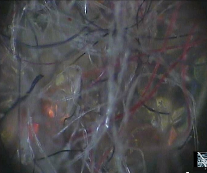 contrailscience.com_skitch_MORGELLONS_EVIDENCE_YOUR_MD_s_Can_t_Deny_21___YouTube_20121114_172602.jpg