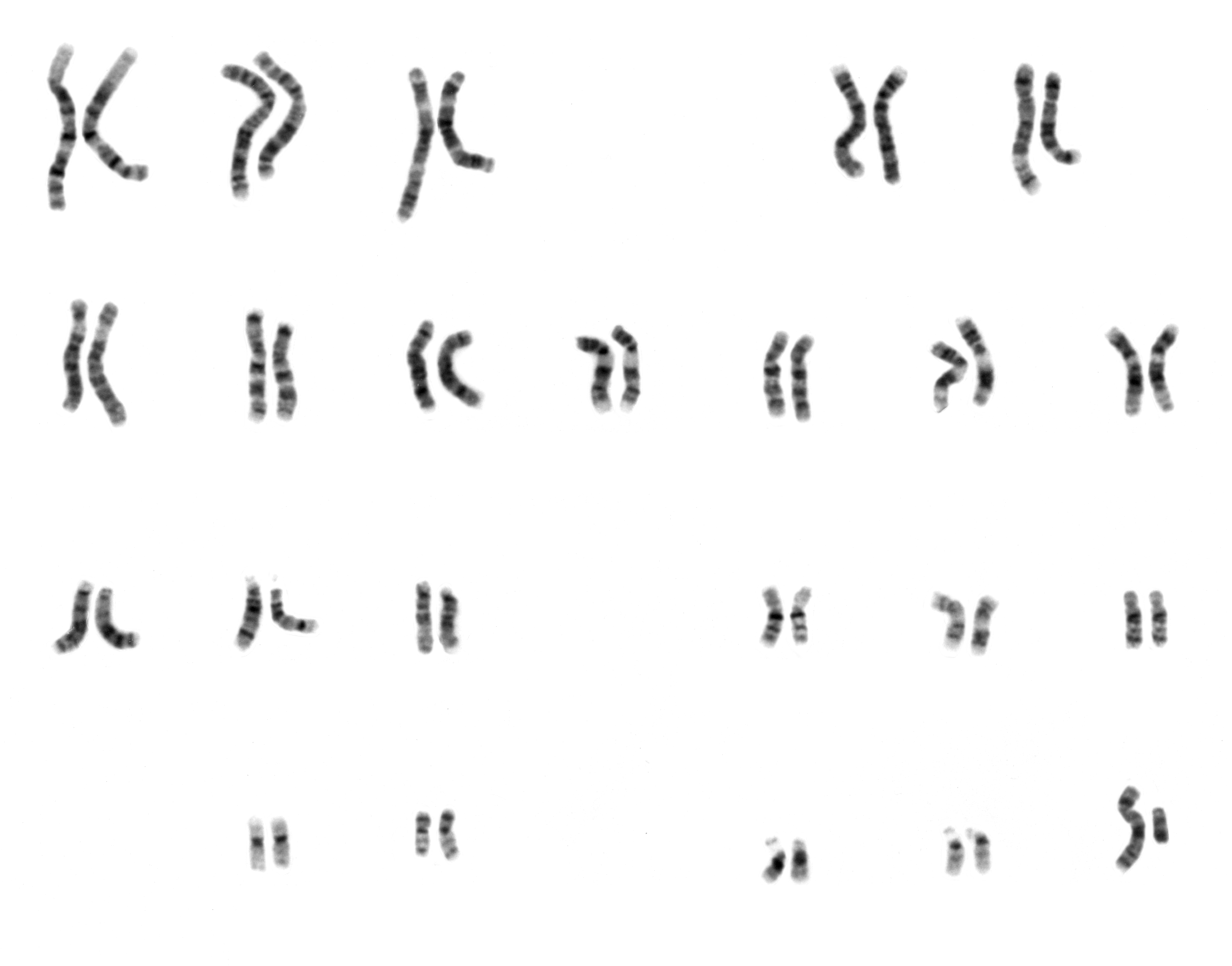 upload.wikimedia.org_wikipedia_commons_5_53_NHGRI_human_male_karyotype.png