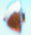 Balwyn UFO hi res tree.png