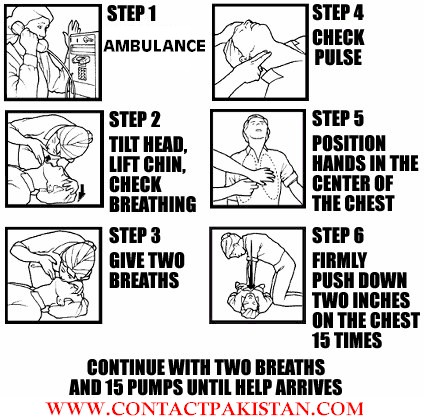 How to perform CPR Guide B.jpg