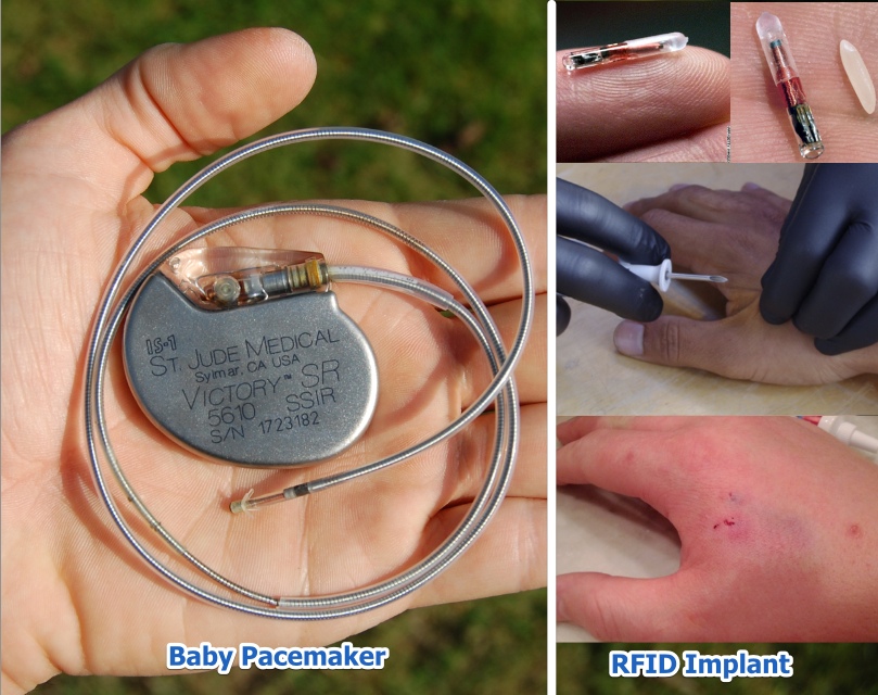 St_Jude_Medical_pacemaker_in_hand__33.3_SLOC_20070918_1_RGB8__20140214_105627_20140214_105756.jpg